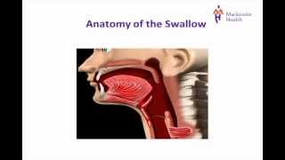 Stroke Education  Dysphagia [upl. by Roose]