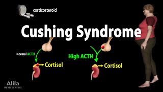 Cushing Syndrome Animation [upl. by Salvador]