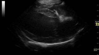 echocardiography of canine second degree heart block [upl. by Denny]