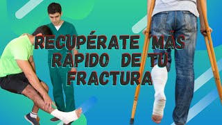 Recupérate más rápido de tu fractura [upl. by Athalee]