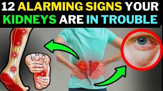 12 Early Signs of Severe Kidney Damage That Could Save Your Life [upl. by Cychosz]