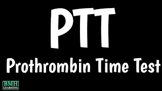 Prothrombin Time Test  PTT  PT Test  How To Interpret Prothrombin Time [upl. by Keram9]