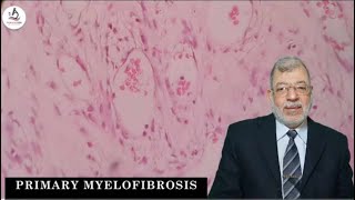 8 Primary Myelofibrosis [upl. by Myrtie989]