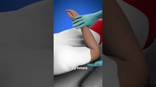 Should Dislocation Treatment  3 D Animation anatomy fracture shortsvideo viralvideo [upl. by Atile]