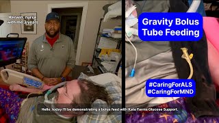 Caring for ALS Gravity Bolus Tube Feeding [upl. by Fabrienne]