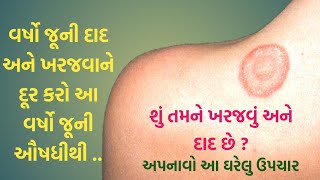 દાદરધાધર મટાડવાનો ઘરગથ્થુ ઉપચાર Ring warms treatmentદાદર અને ખરજવું મટાડવાનો અકસીર પ્રયોગ [upl. by Essirahc]