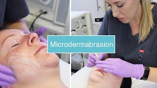 Microdermabrasion  The Laser and Skin Clinic [upl. by Ecnerewal]