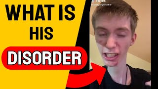 What disorder does Daddy Long Neck have [upl. by Rozek741]