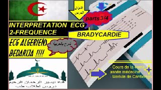 ECG ALGERIENS BEDARIJA 83 INTERPRETATION ECG FREQUENCE CARDIAQUE PARTS 34 BRADYCARDIE [upl. by Ayian]