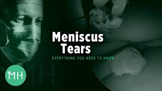 Meniscus Tears  Everything you need to know [upl. by Britton]