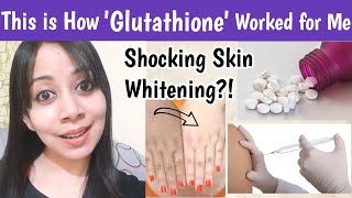 Glutathione Works for Skin Whitening For Tan removal Pigmentations Glutathione before and after [upl. by Gianni]