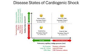 cardiogenic shock [upl. by Lednek]