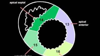 Volodymyr Pavliuk MD PhD Echocardiographic Assesment of Left Ventricular Systolic Function [upl. by Corry236]