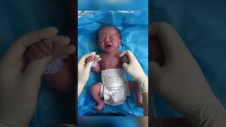 The nurse helped the newborn check his body The newborns small body is very cute [upl. by Adlecirg]