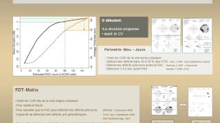 Surveillance du glaucome  Champ Visuel May F [upl. by Esilegna]