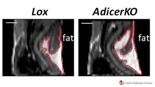 Joslin Scientists Identify Process that Affects Fat Distribution and Metabolic Syndrome [upl. by Anoyet]