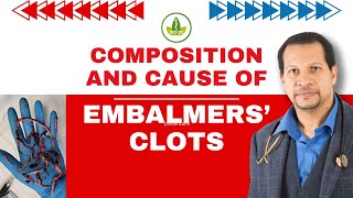 Embalmers Clots EXPOSED Whats Really Causing Them [upl. by Carleen]