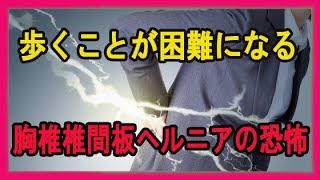 歩くことが困難になる胸椎椎間板ヘルニアの原因と治療法 [upl. by Marcello492]