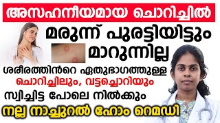 ശരീരത്തിന്റെ ഏതുഭാഗത്തുള്ള ചൊറിച്ചിലും വട്ടച്ചൊറിയും മാറാൻ നല്ല നാച്ചുറൽ ഹോം റെമഡിvattachori maran [upl. by Mayman]