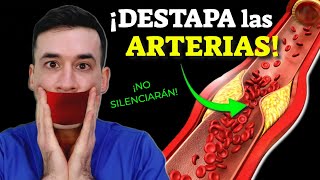 DESTAPA LAS ARTERIAS ¡SIN REMEDIOS [upl. by Sladen]