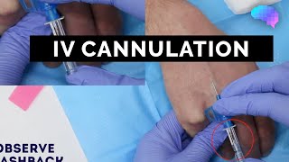 Intravenous IV cannulation  OSCE Guide  UKMLA  CPSA [upl. by Geilich]