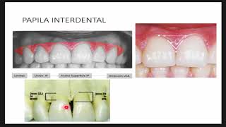 ENAO PERIODONCIA Parte 1 [upl. by Idner]