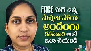 Face మీద ఉన్న మచ్చలు పోయి అందంగా కనపడాలి అంటే ఇలా చేయండి  Skin Care  Skin Care Tips amp Tricks [upl. by Ethbin]