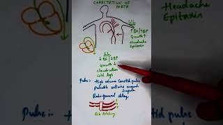 Coarctation of Aorta [upl. by Purdum119]