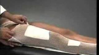 Bandafix® leg bandage [upl. by Odelle72]