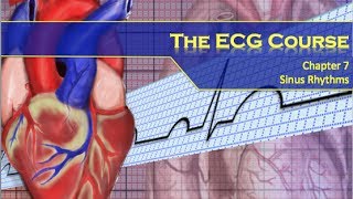 The ECG Course  Sinus Rhythms [upl. by Normy180]