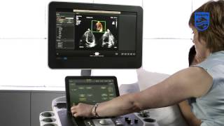 How to Perform a Full Volume Acquisition on a Philips EPIQ Ultrasound [upl. by Fontana]