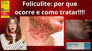 Foliculite por que ocorre e como tratar [upl. by Neall]