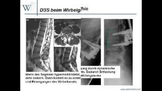 Video dynamische Stabilisierung [upl. by Lang]