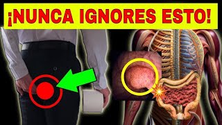 CÁNCER DE COLON 10 SÍNTOMAS de ALARMA que NO DEBES IGNORAR [upl. by Crow]