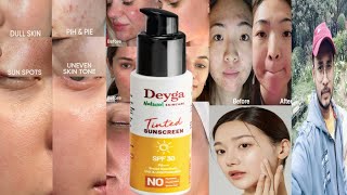 Deyga Tinted Sunscreen SPF 30  Honest Review [upl. by Jahn]