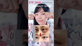 ONLY 1 EXERCISE Remove Eye Bags Permanently [upl. by Torp]