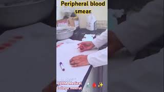 Peripheral blood smear PBS dmlt medical lab 🔬🩸✨ [upl. by Euqinomahs]