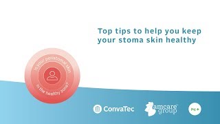 Top tips for maintaining healthy peristomal skin [upl. by Avera]