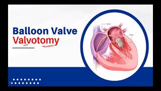 IM Cardiology 10 Valvular Heart Diseases Mitral Stenosis MS Treatment [upl. by Yrrab]