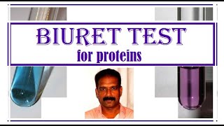 BIURET Test for Protein BIOCHEMISTRY CLASSES [upl. by Adlin]