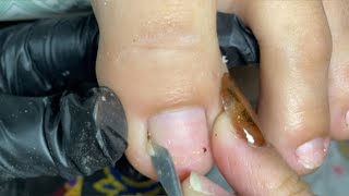 Home Pedicure Vlog💅 By JeanManicurista IngrownDryskin Removal [upl. by Nagem]