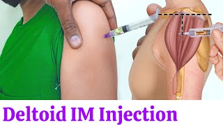 How to give deltoid intramuscular IM injection easily at Home [upl. by Lussi]