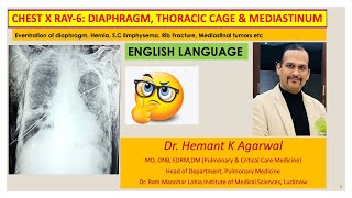 Radiology Chest X Ray6 ENGLISH Diaphragm Chest wall and MediastinumDr Hemant K Agarwal [upl. by Ztnaj937]