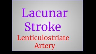 Lacunar Stroke [upl. by Morlee]