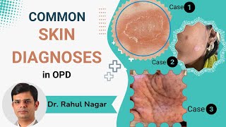 Common Skin Diagnoses In OPD [upl. by Luht598]