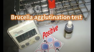 Brucella rapid agglutination test [upl. by Anirtap]