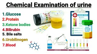 Chemical Examination of urine  Urine analysis  Glucose in urine  Glycosuria Explain in hindi [upl. by Tirb]