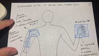 Traumatología Fracturas y complicaciones Esquema 23 [upl. by Aretak979]