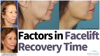 How Facelift Recovery can be Faster Without Compromising Results or Longevity [upl. by Hnib]