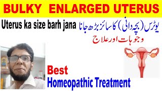 bulky uterus treatment in urdu hindiBacha dani ka size badrhnabulky uterus ka ilaj homeopathic [upl. by Chaddy162]